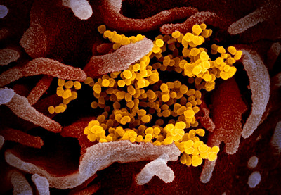 Electron microscope image of novel coronavirus
