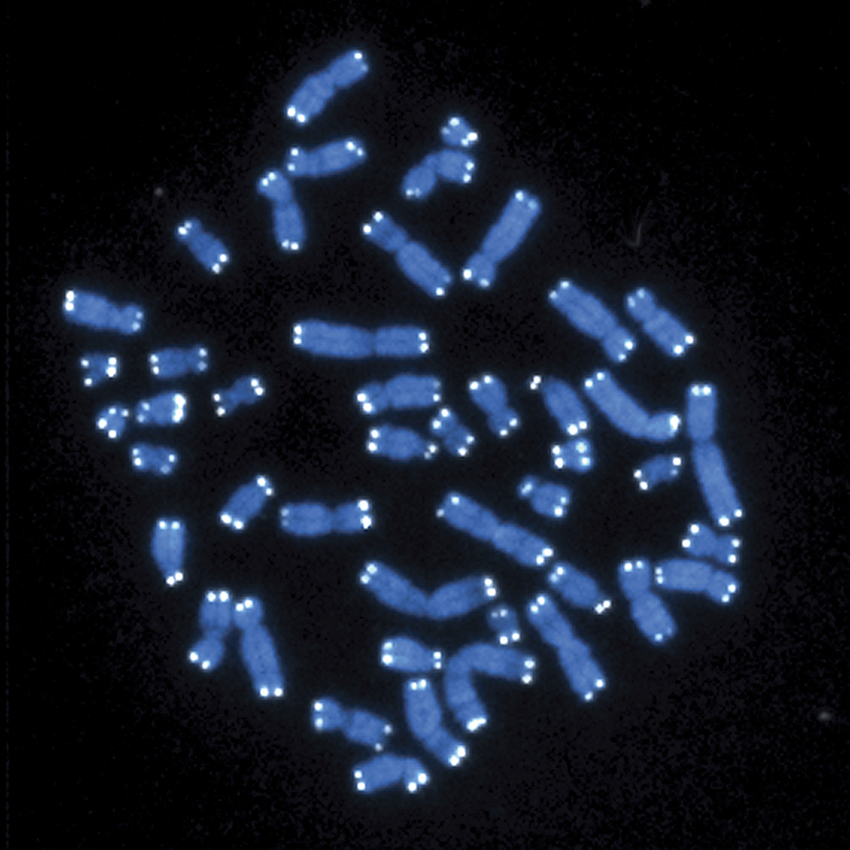Blue chromosomes under a microscope