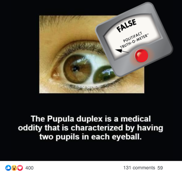 False image eye condition claim