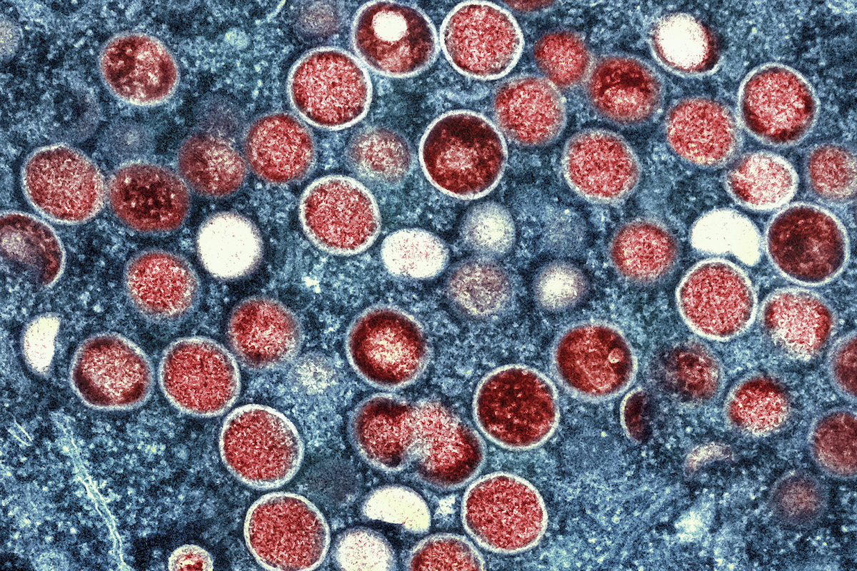 NIAID colorized transmission electron micrograph of monkeypox particles