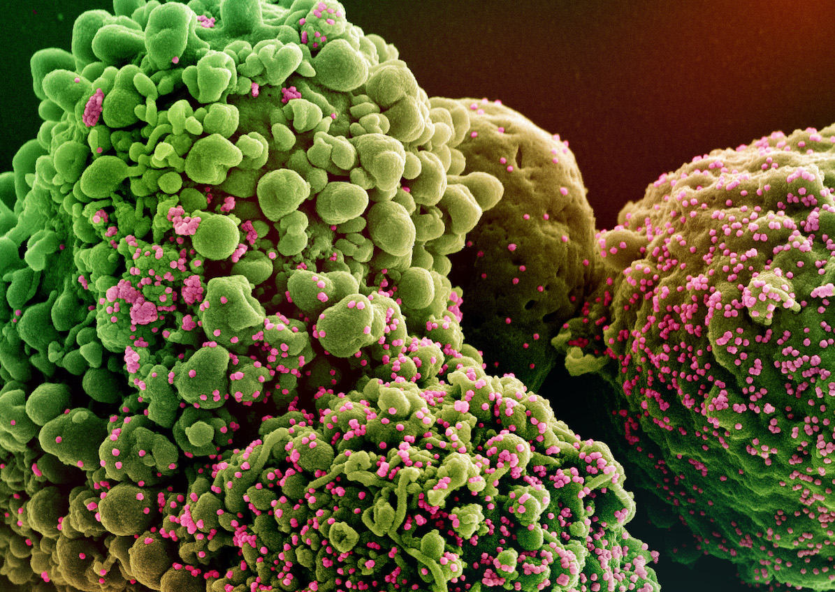 NIAID image of omicron infected cell