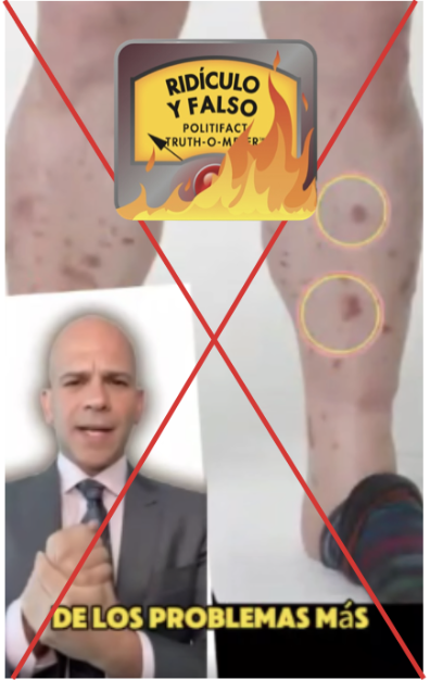 Grafico POF del Dr. Rivera 08/30/24