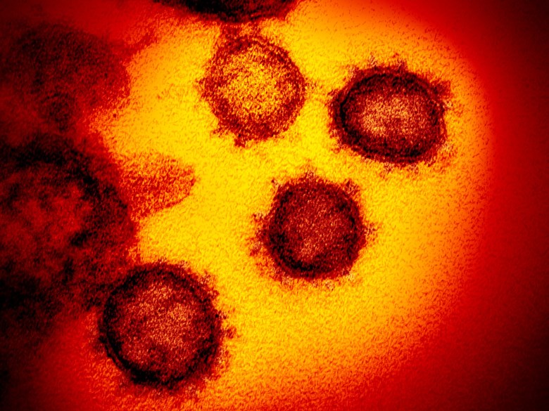 Coronavirus image via NIH