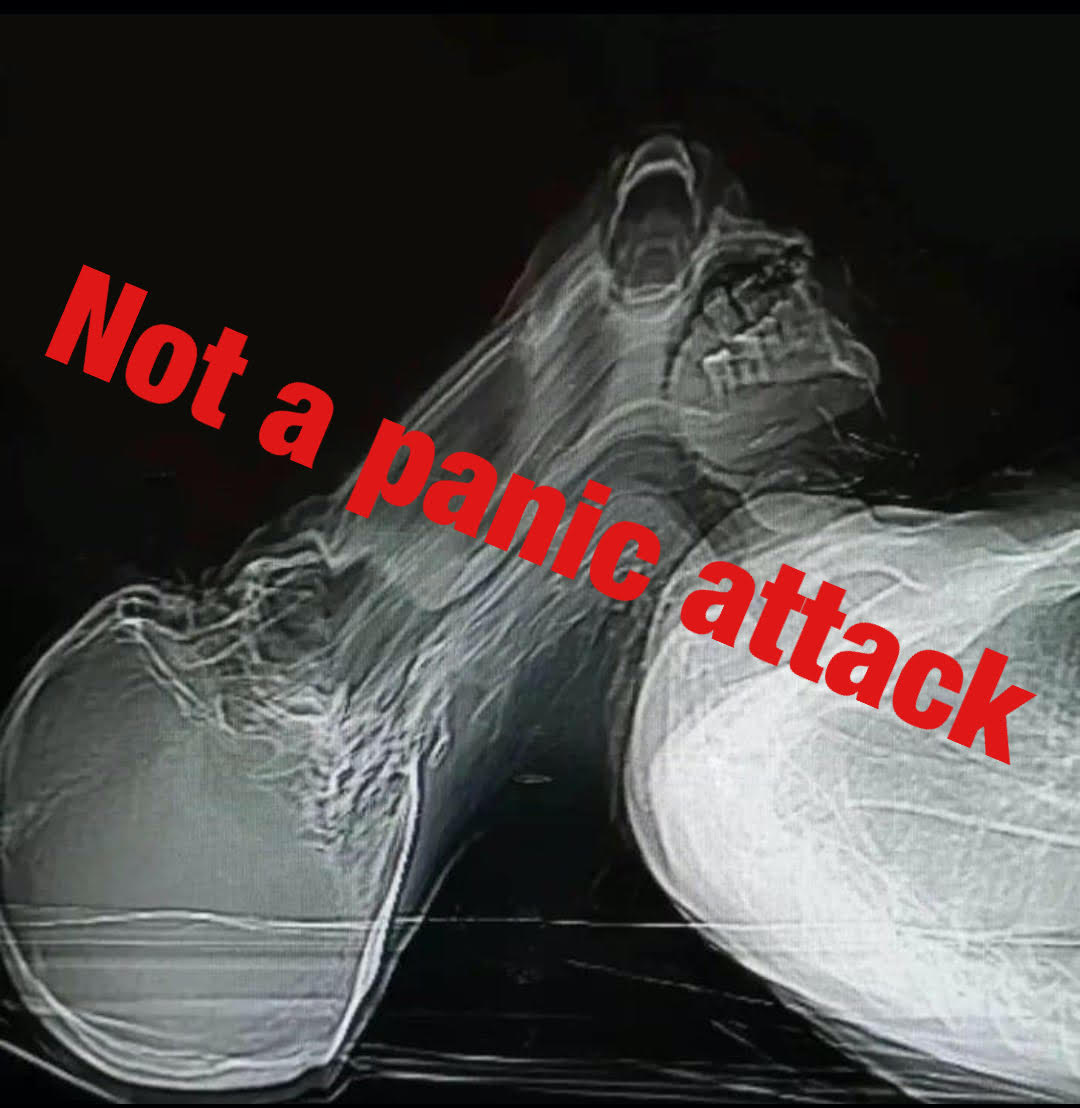 CT panic attack meme