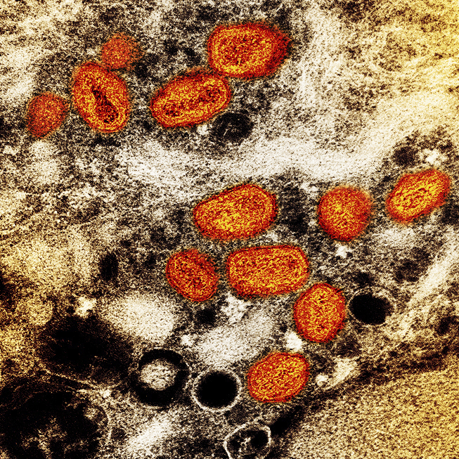 Colorized transmission electron micrograph of orange monkeypox particles