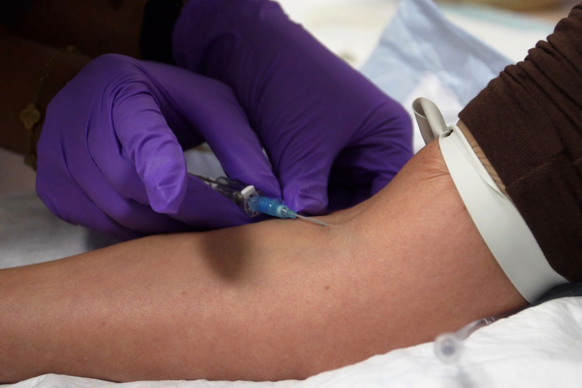 IV peptide infusion California Nov. 2025